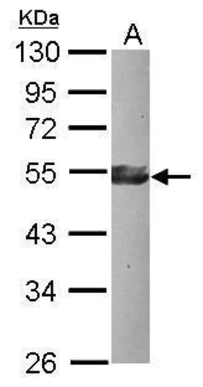 100uL Polyclonal antibody, KLF17, host r