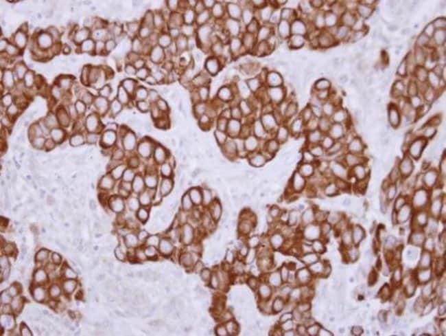 100uL Polyclonal antibody, keratin 36, h