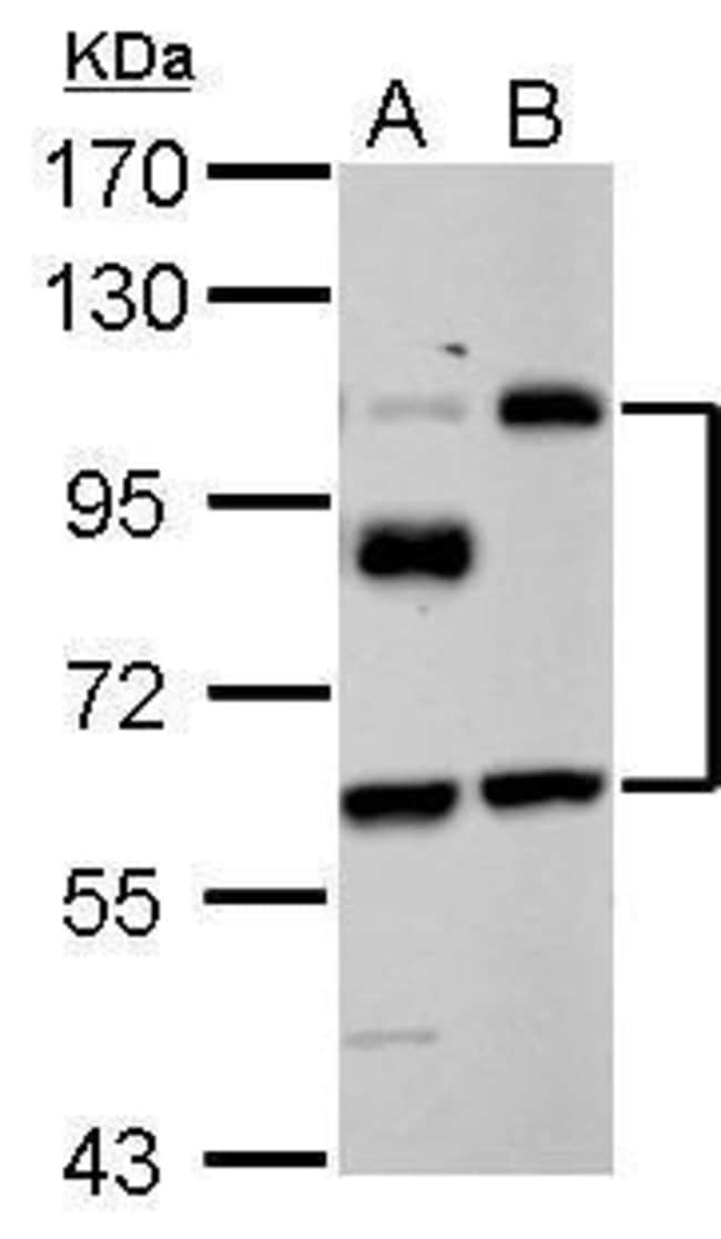 100uL Polyclonal antibody, EPLIN, host r