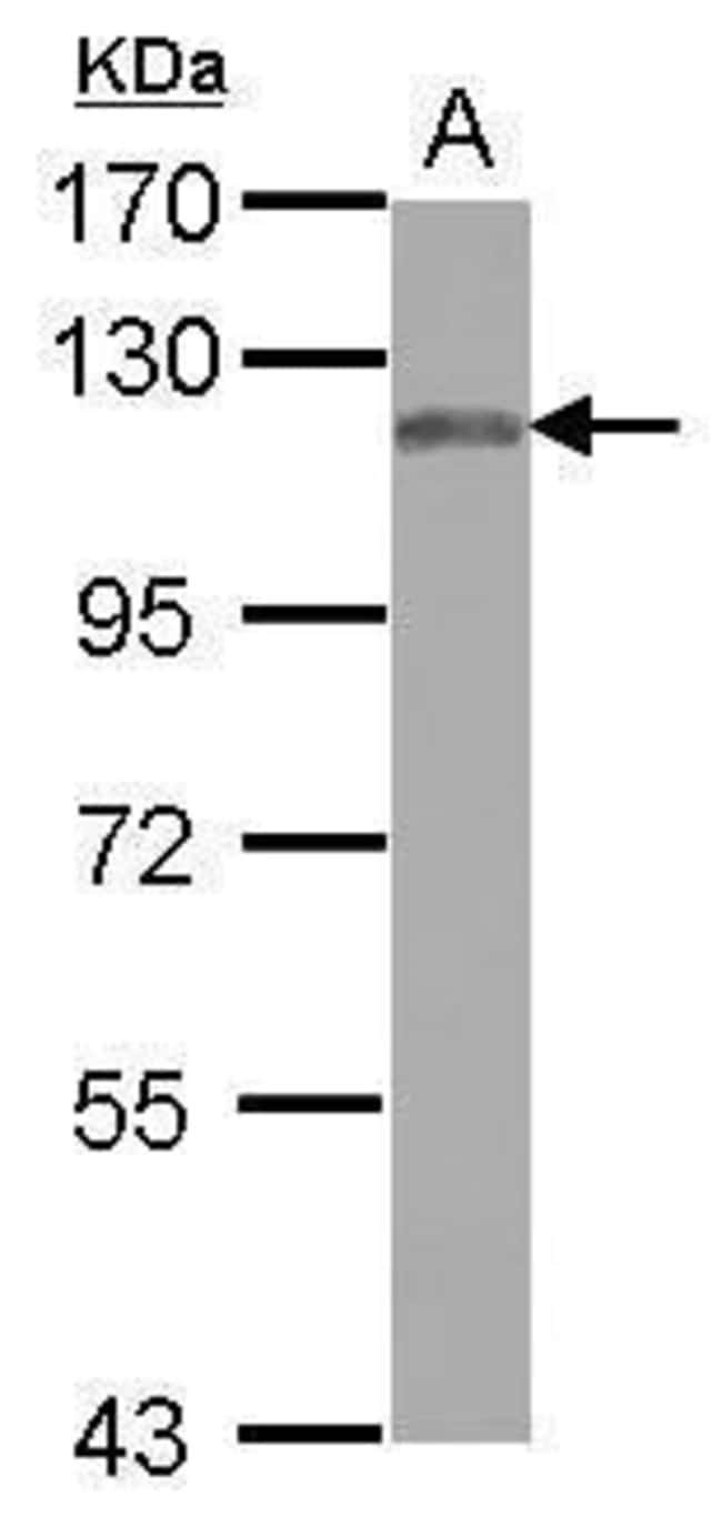 100uL Polyclonal antibody, MAN2B2, host