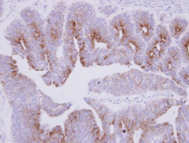 100uL Polyclonal antibody, MAP7, host ra