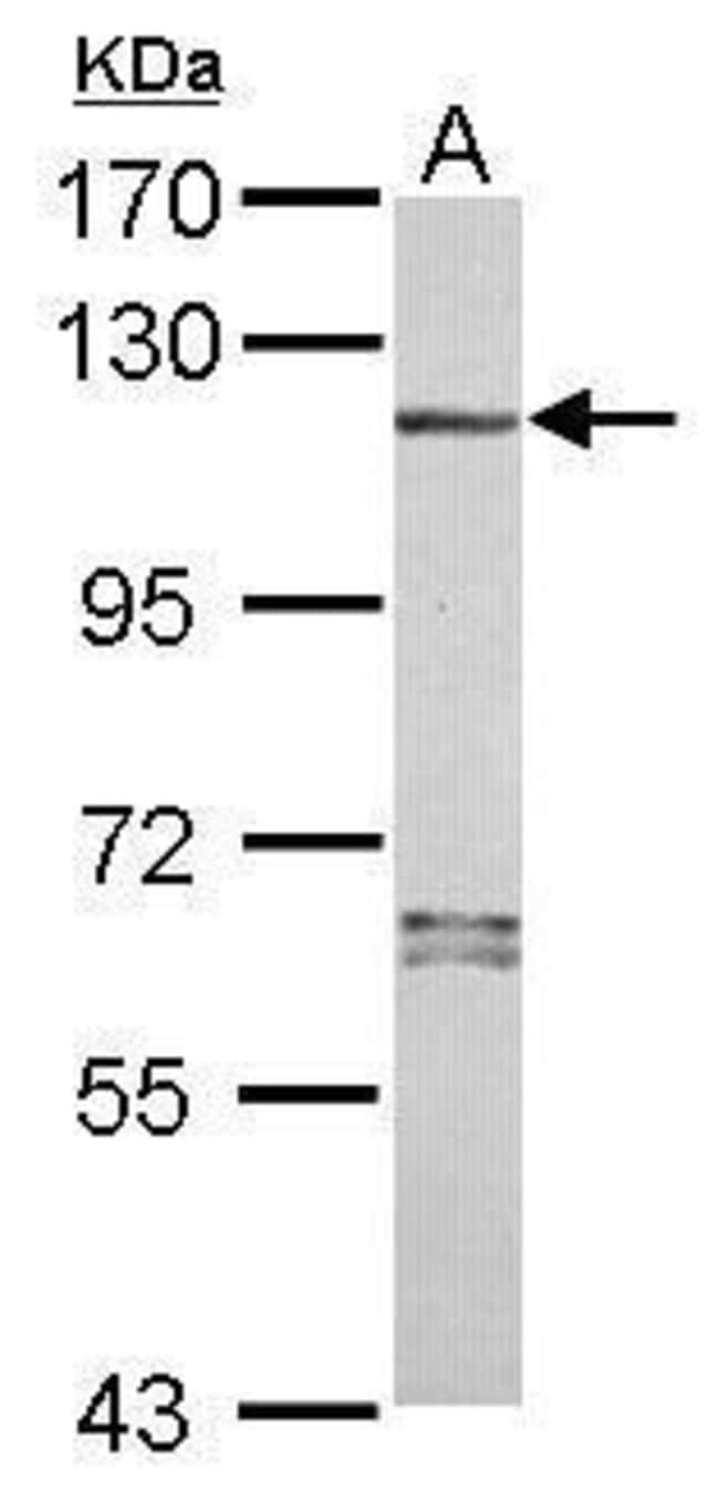 100uL Polyclonal antibody, NLRP7, host r
