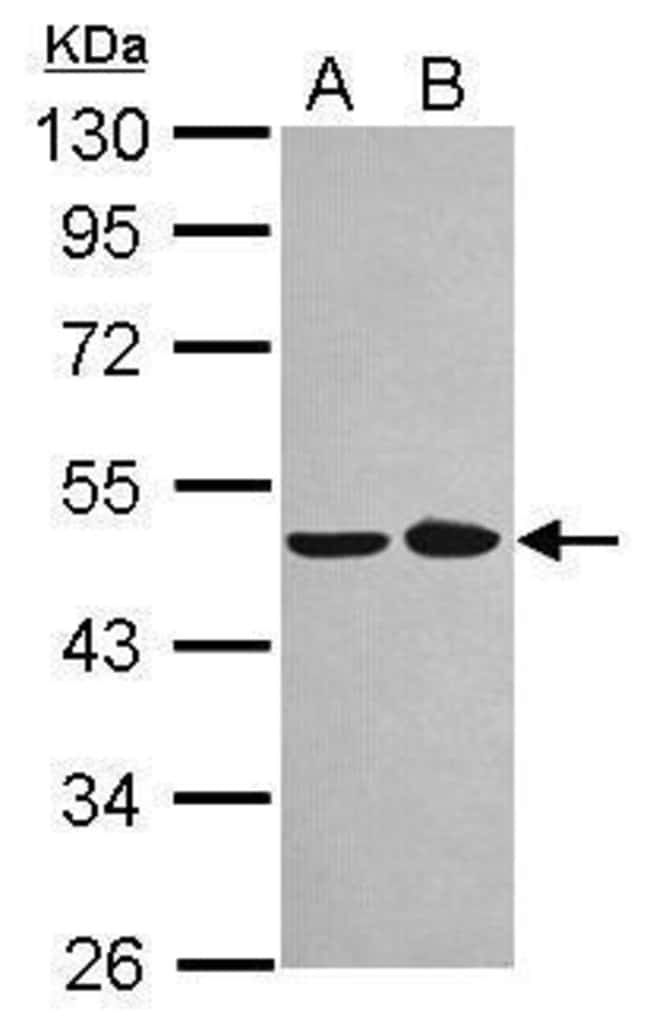 100uL Polyclonal antibody, NOB1, host ra