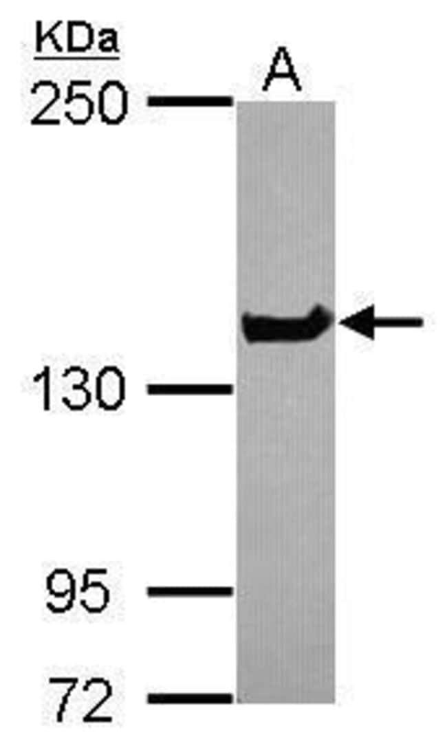100uL Polyclonal antibody, NUP155, host
