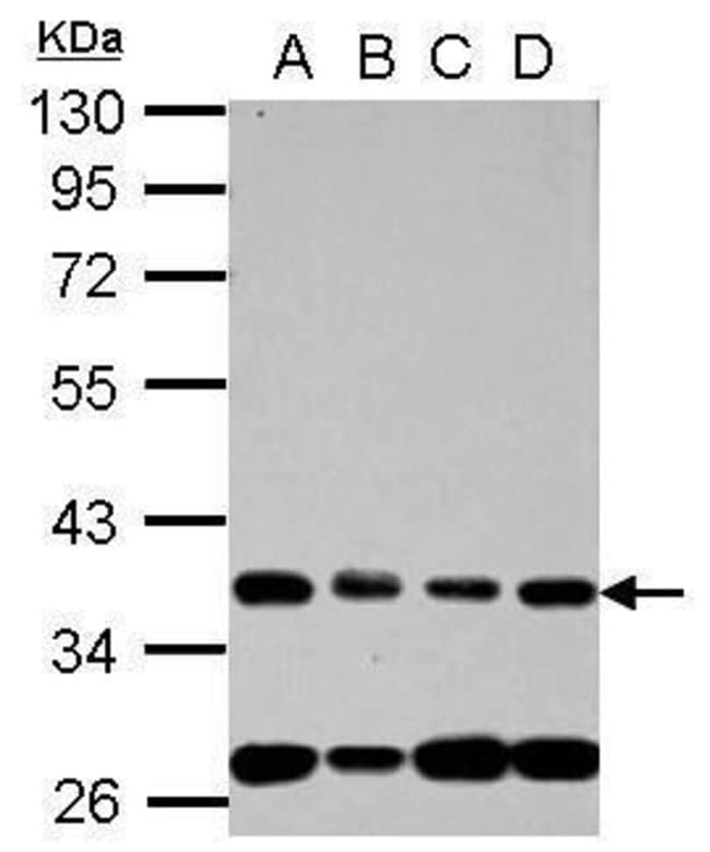100uL Polyclonal antibody, Nup53, host r