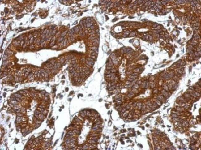 100uL Polyclonal antibody, ORAI2, host r