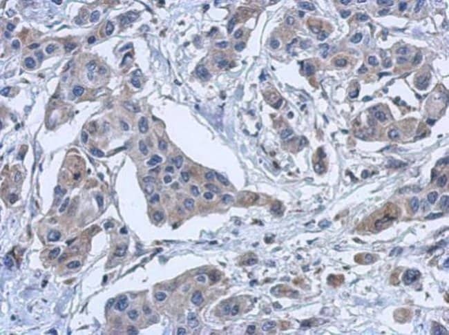 100uL Polyclonal antibody, PYROXD2, host