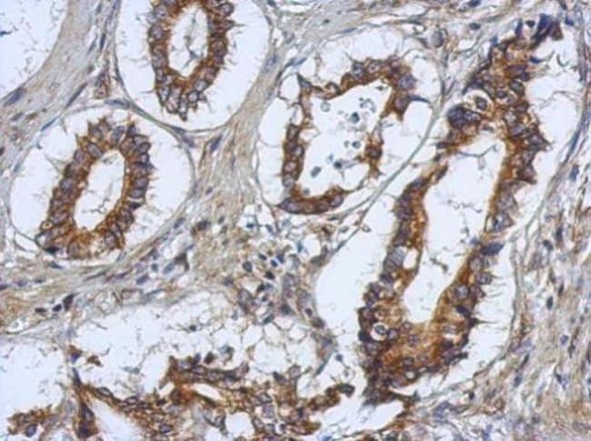 100uL Polyclonal antibody, RASAL2, host