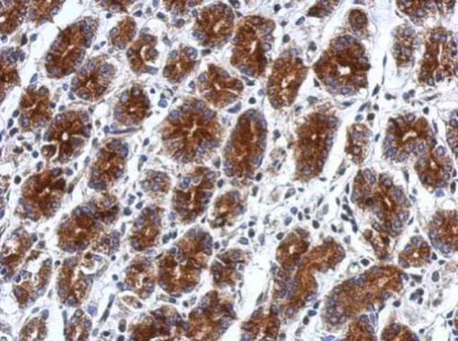 100uL Polyclonal antibody, RILPL2, host