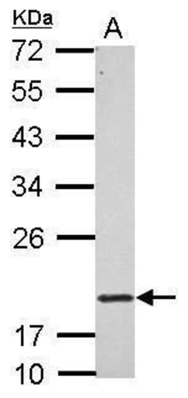100uL Polyclonal antibody, RNF5, host ra