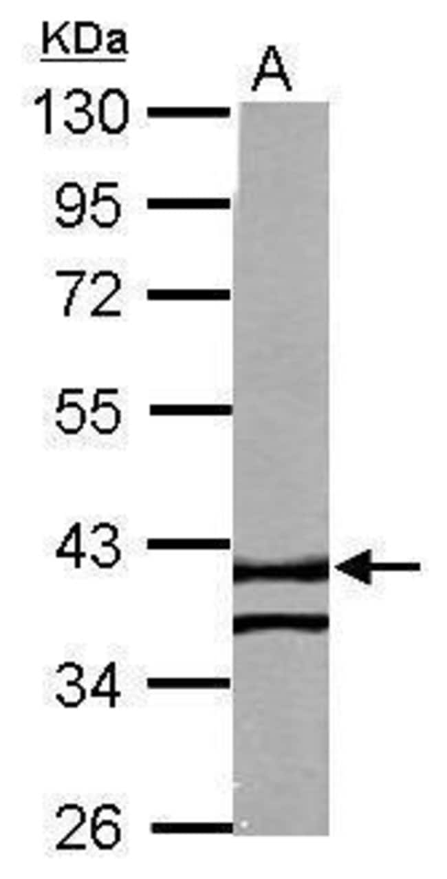 100uL Polyclonal antibody, RTN4IP1, host