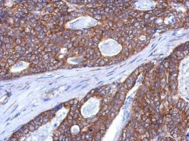 100uL Polyclonal antibody, SLITRK5, host