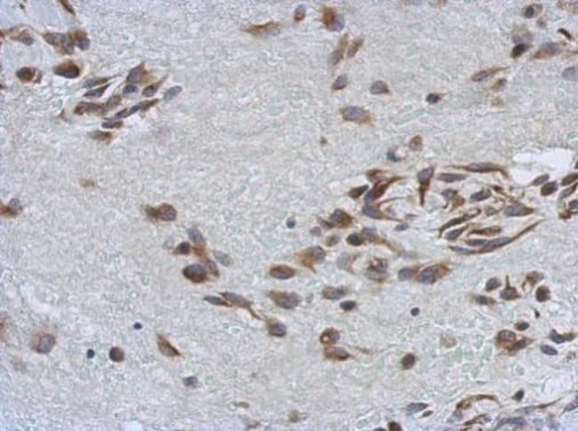 100uL Polyclonal antibody, SSFA2, host r