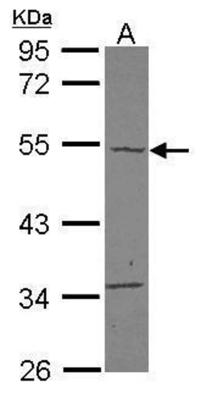 100uL Polyclonal antibody, TBC1D10C, hos