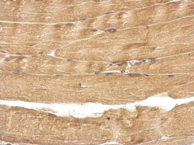 100uL Polyclonal antibody, TBC1D15, host