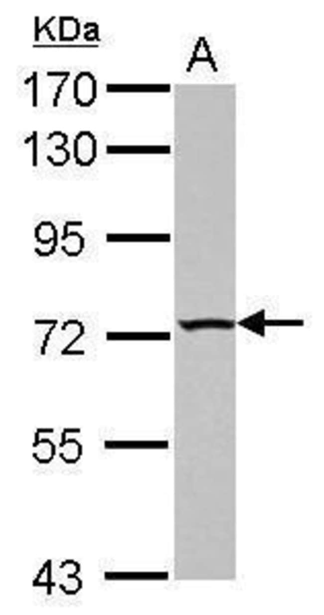 100uL Polyclonal antibody, TBC1D15, host