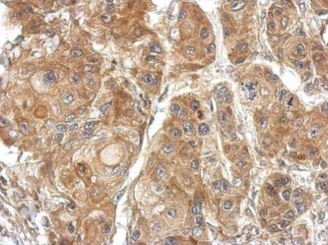 100uL Polyclonal antibody, TSR2, host ra