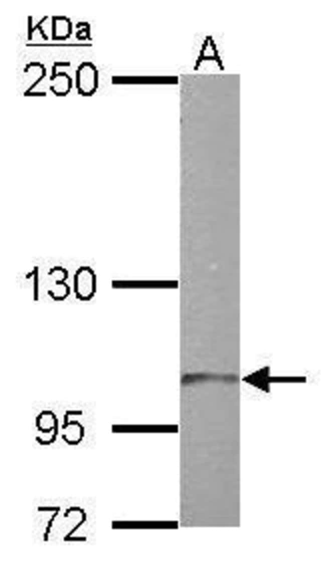 100uL Polyclonal antibody, TTLL7, host r