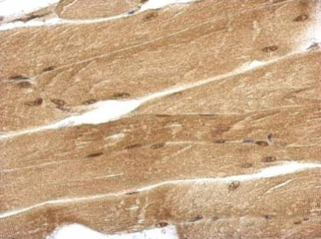 100uL Polyclonal antibody, ubiquilin 4,