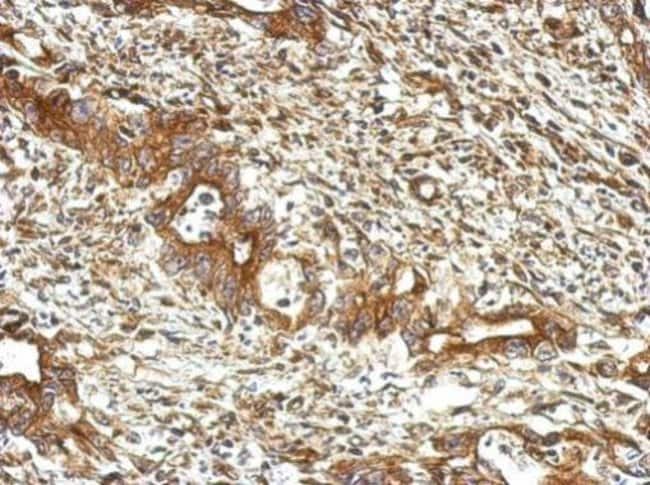 100uL Polyclonal antibody, UBXN1, host r