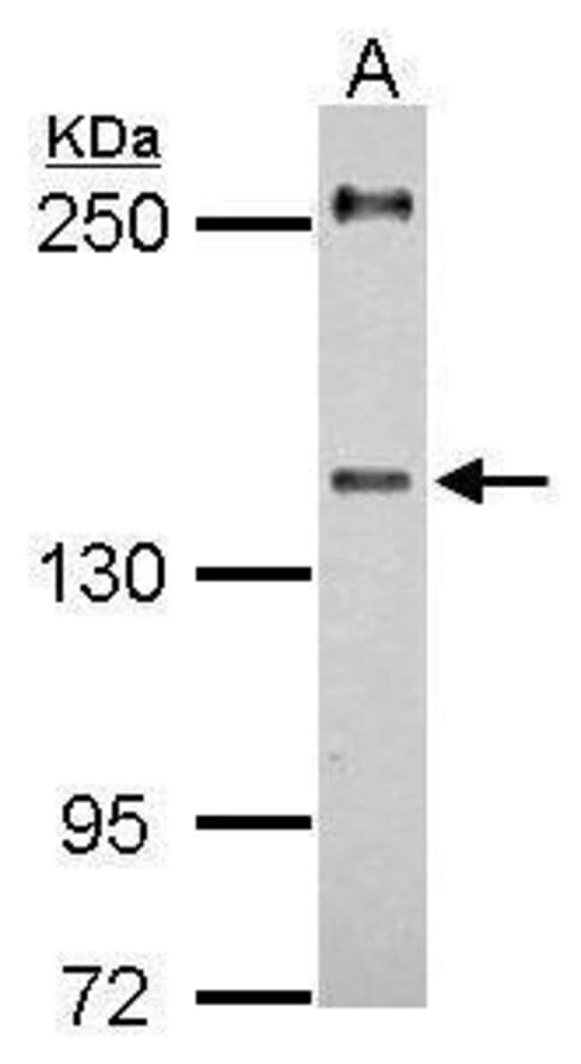 100uL Polyclonal antibody, URB2, host ra
