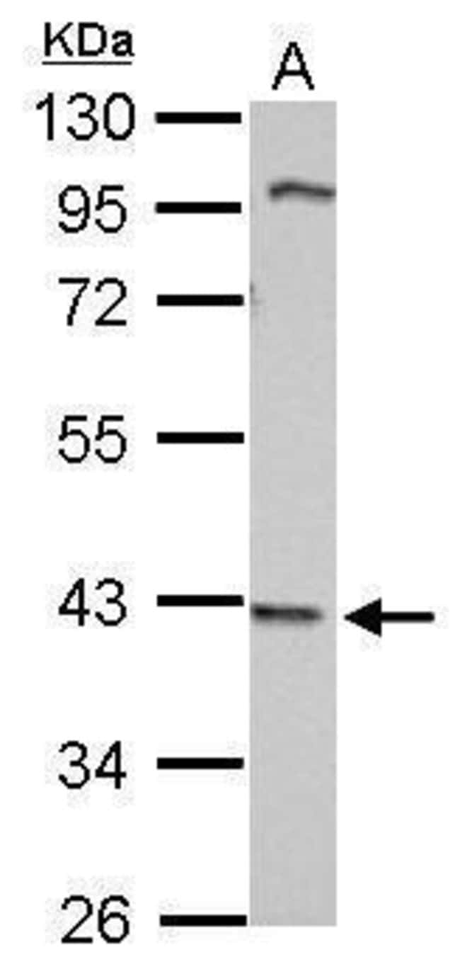 100uL Polyclonal antibody, WDR69, host r