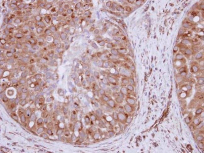 100uL Polyclonal antibody, XPO6, host ra