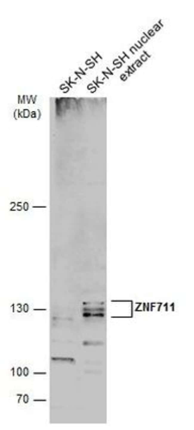 100uL Polyclonal antibody, ZNF711, host