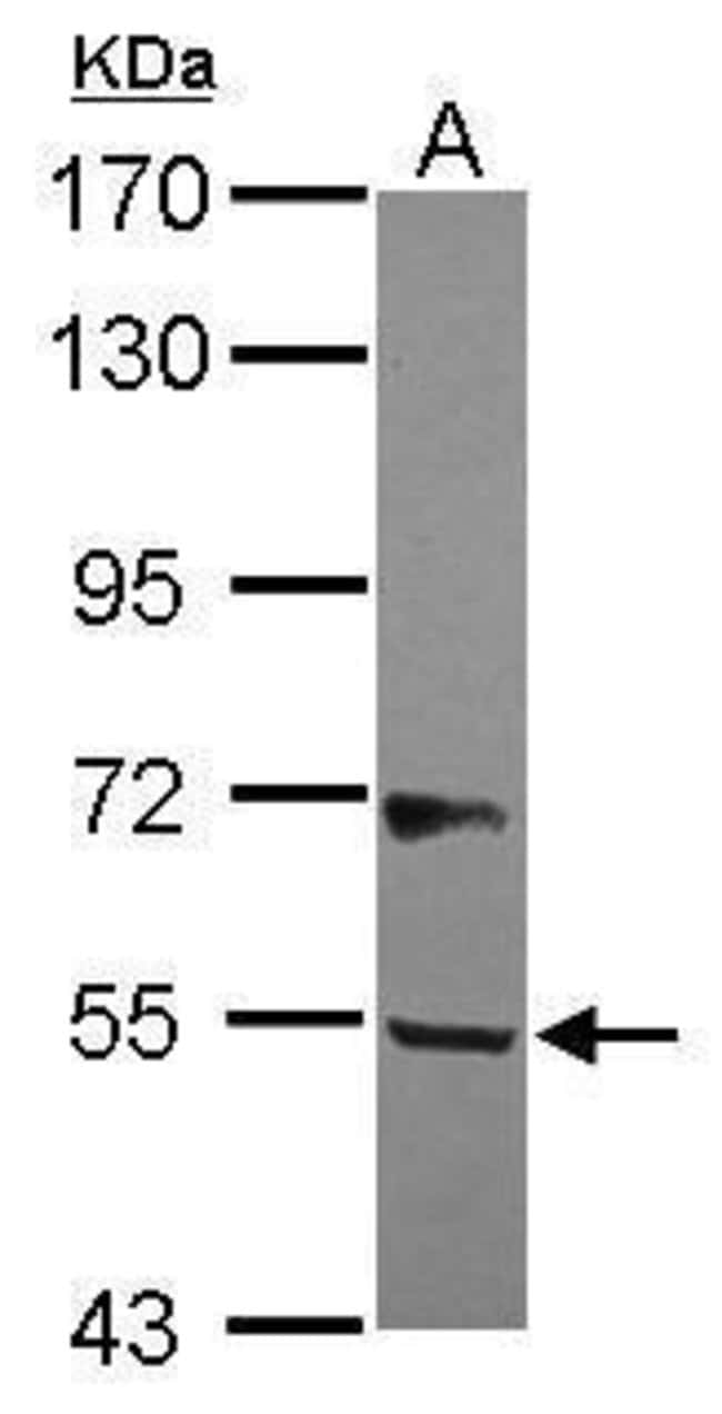 100uL Polyclonal antibody, B3GALNT2, hos