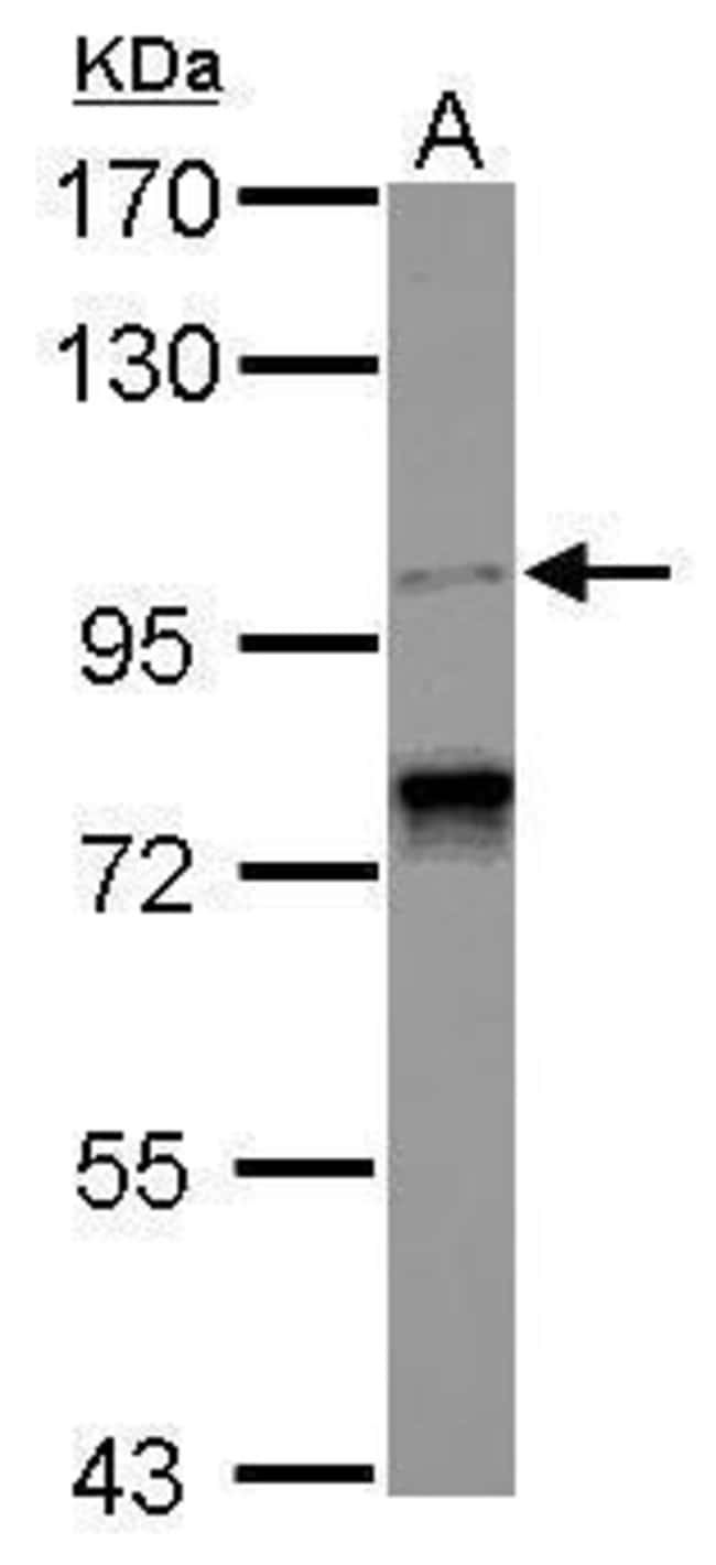 100uL Polyclonal antibody, CCDC52, host