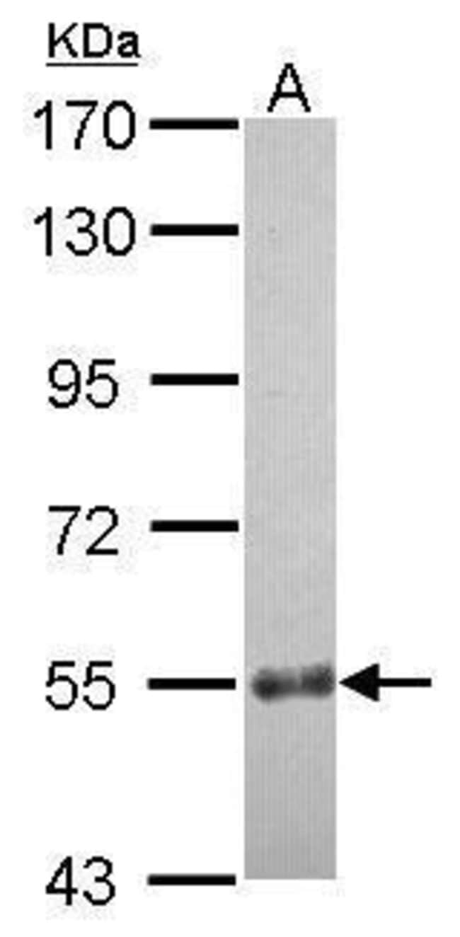 100uL Polyclonal antibody, CCDC7, host r