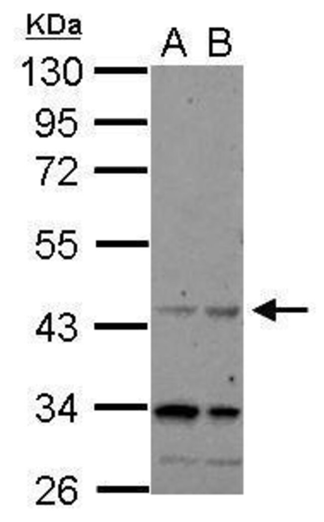 100uL Polyclonal antibody, CHRFAM7A, hos