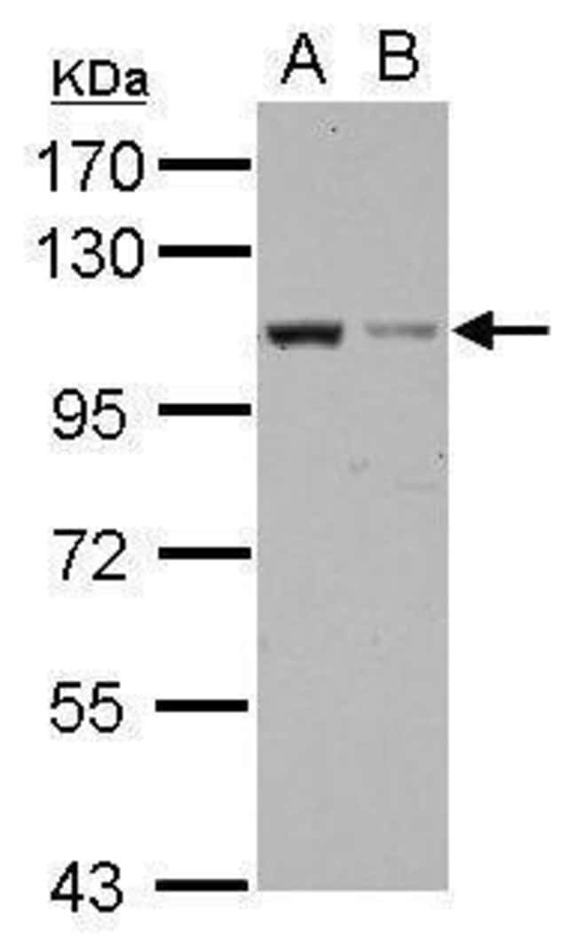 100uL Polyclonal antibody, EXOC2, host r