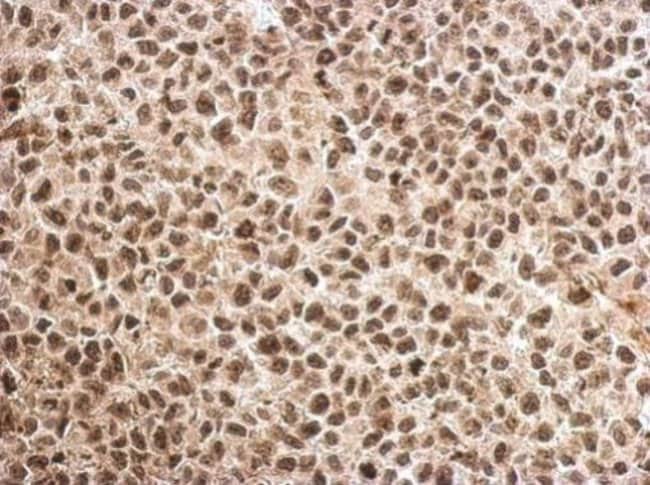 100uL Polyclonal antibody, MAGEB18, host