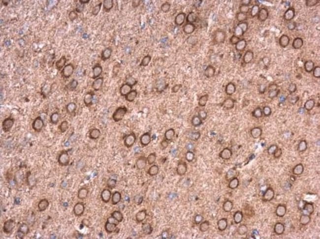 100uL Polyclonal antibody, neurocalcin d