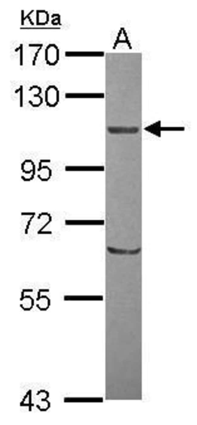 100uL Polyclonal antibody, ORP8, host ra