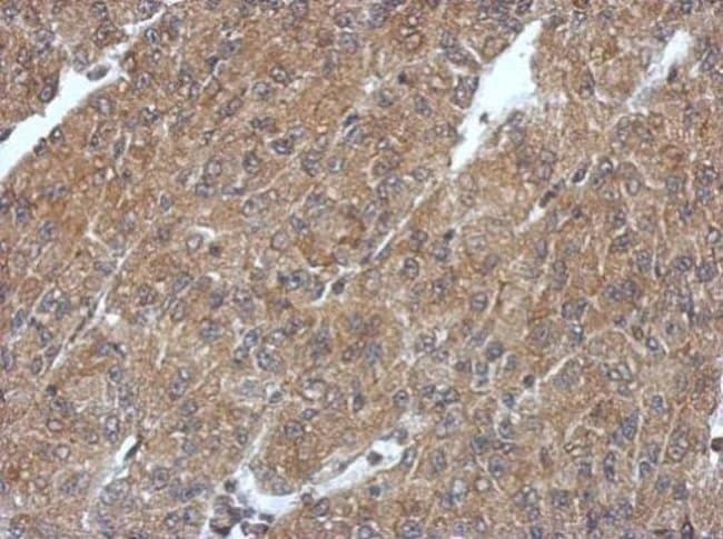 100uL Polyclonal antibody, PHYHIP, host