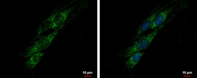 100uL Polyclonal antibody, PITRM1, host
