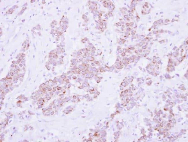 100uL Polyclonal antibody, PSD4, host ra