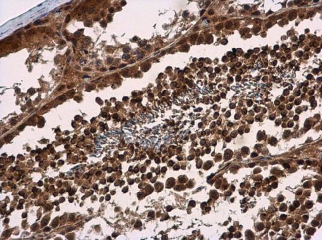 100uL Polyclonal antibody, SMG7, host ra