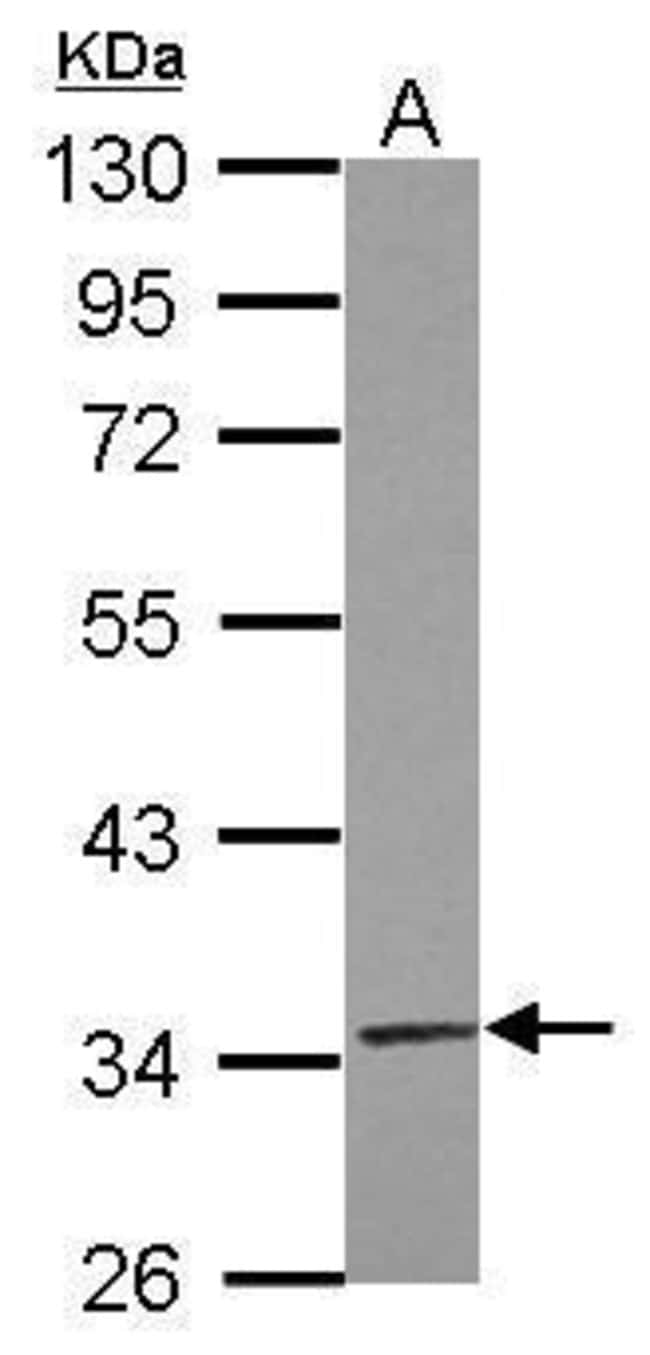 100uL Polyclonal antibody, TRUB2, host r