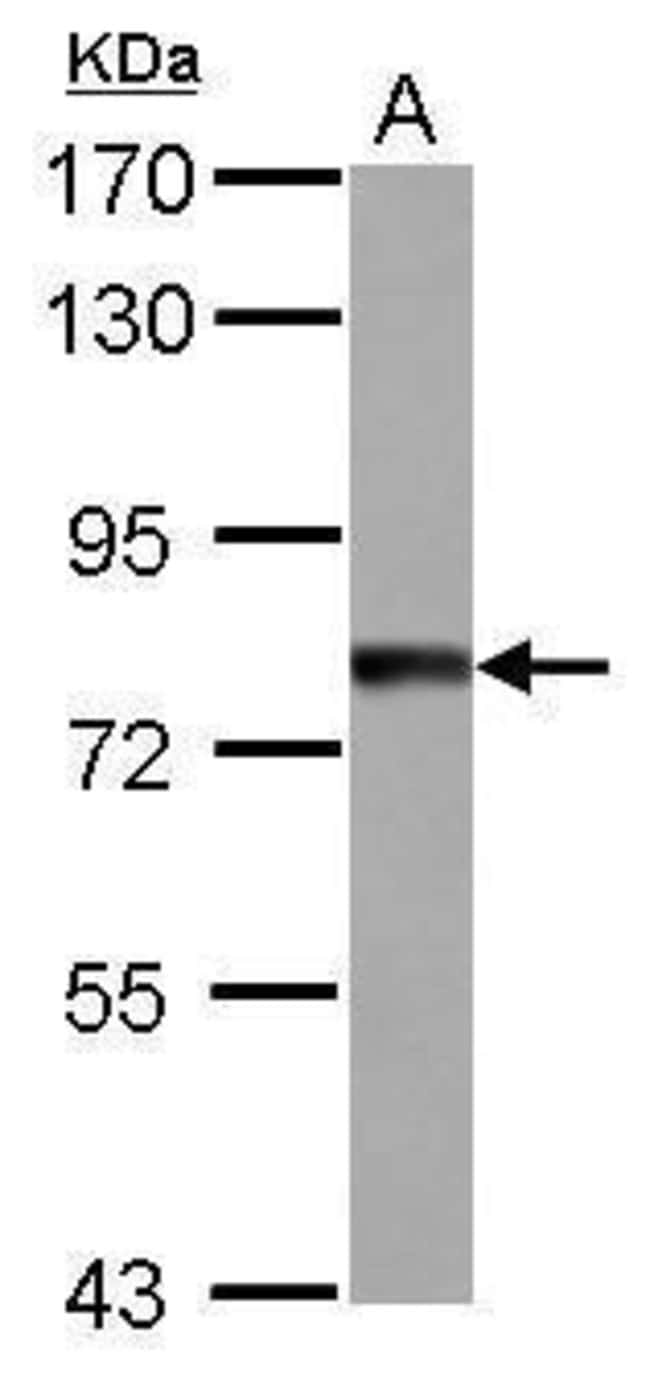 100uL Polyclonal antibody, TTC14, host r