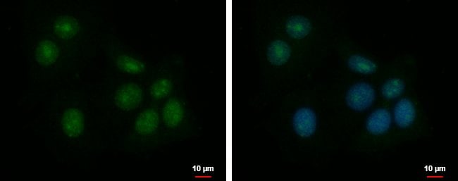 100uL Polyclonal antibody, ZNF417, host