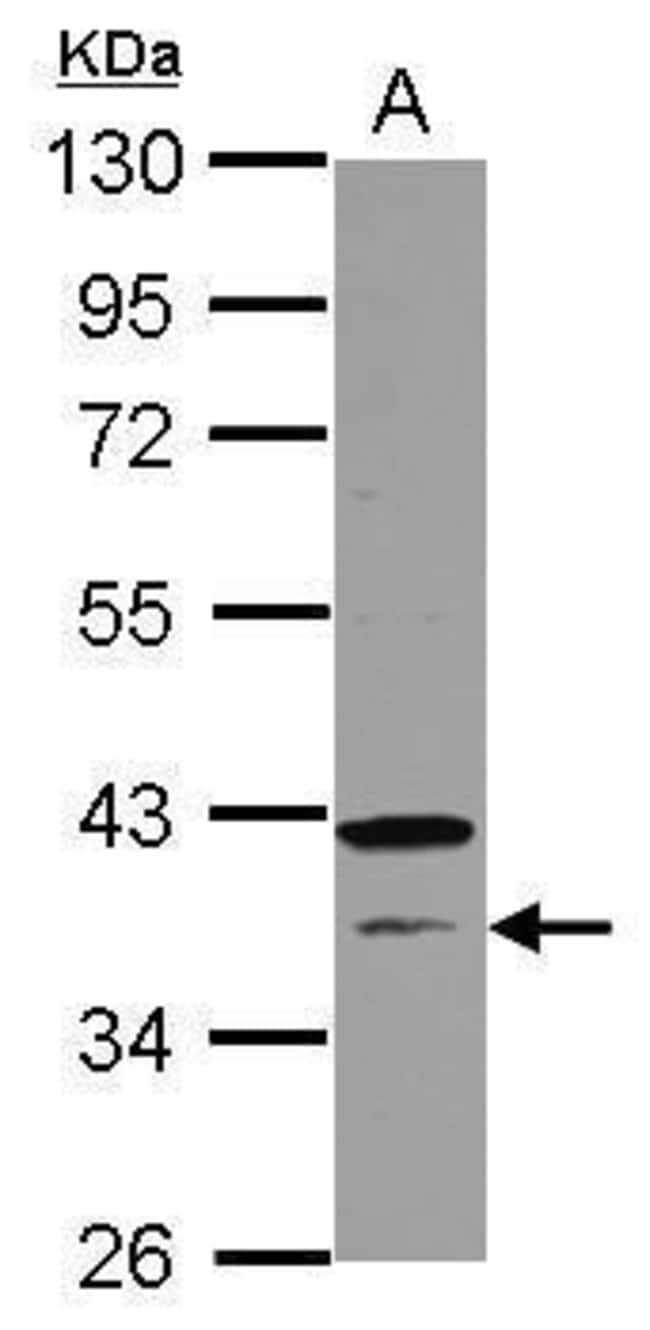 100uL Polyclonal antibody, CNTD1, host r