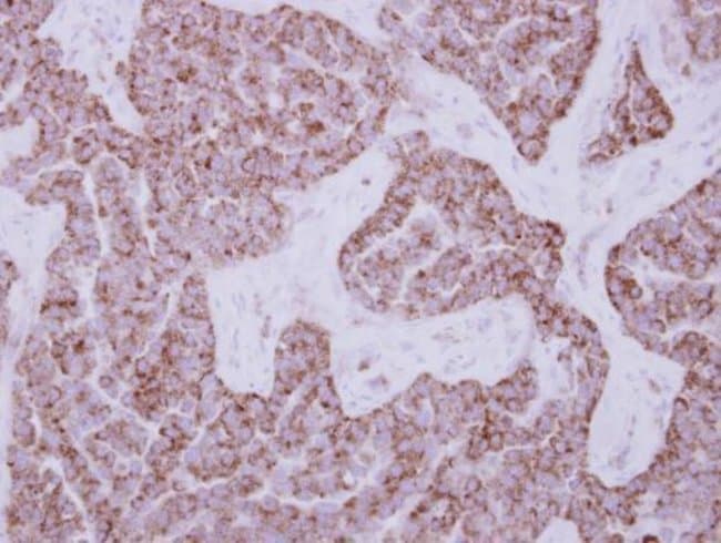 100uL Polyclonal antibody, DUS2L, host r
