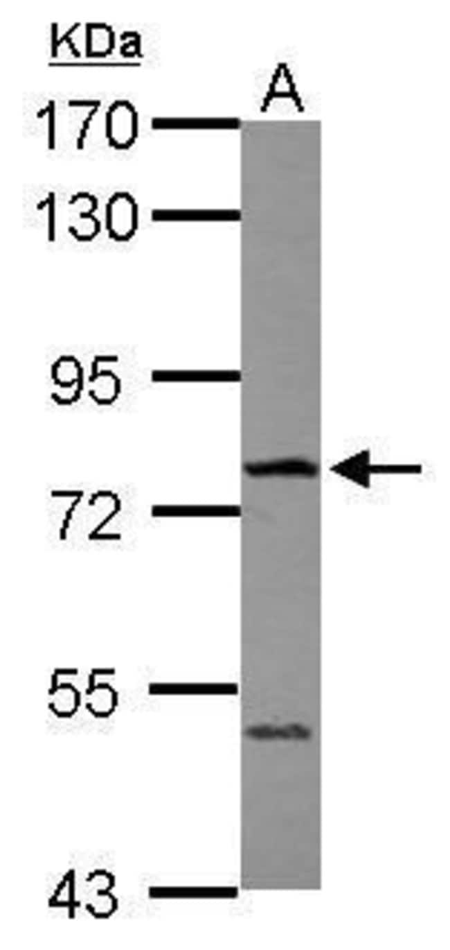 100uL Polyclonal antibody, FBXO21, host