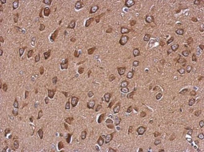 100uL Polyclonal antibody, WDR16, host r