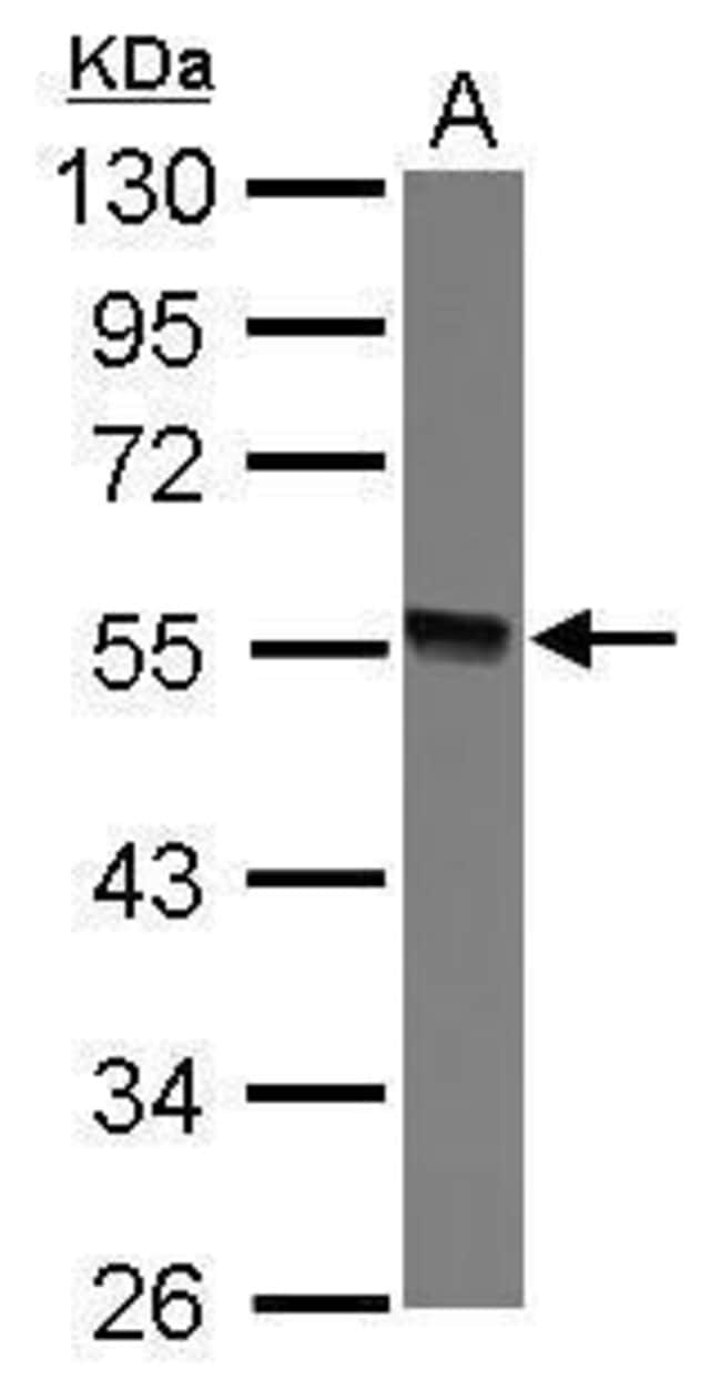 100uL Polyclonal antibody, GTDC1, host r