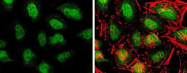 100uL Polyclonal antibody, TET3, host ra
