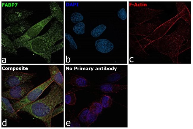 100uL Polyclonal antibody, BLBP, host ra